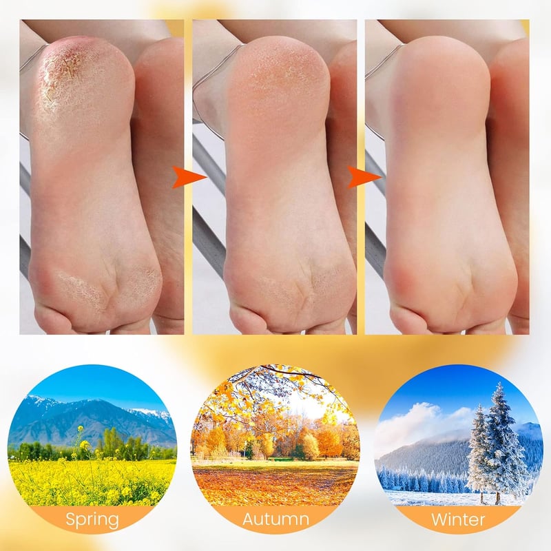 🔥 Moisturising Foot Mask – Exfoliating Silicone Socks – Beach Protective Socks