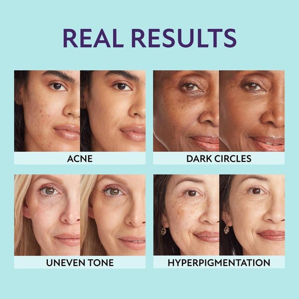 All-in-one moisturiser, concealer & coverage ✨
